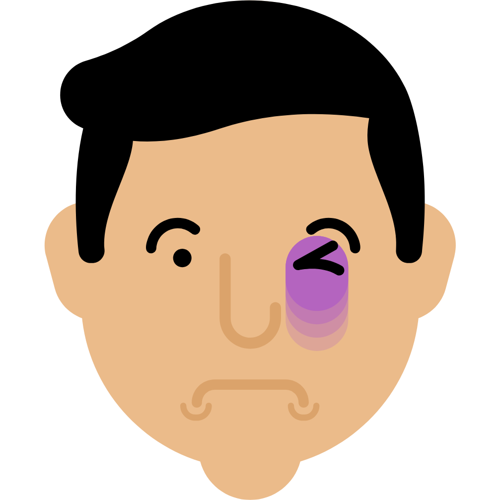 Easy or unexplained-bruising