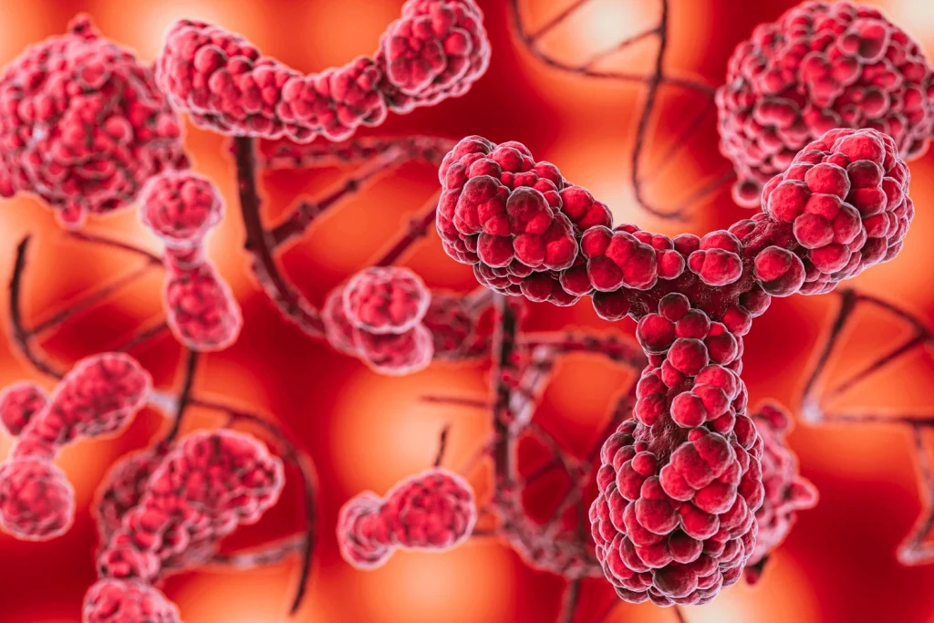 Types of amyloidosis image
