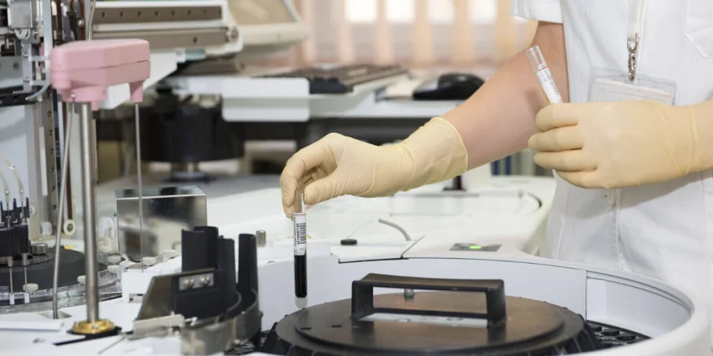 Scientist performing a blood test