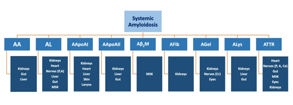 A diagram outlining systemic amyloidosis